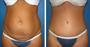 Before & After Photos